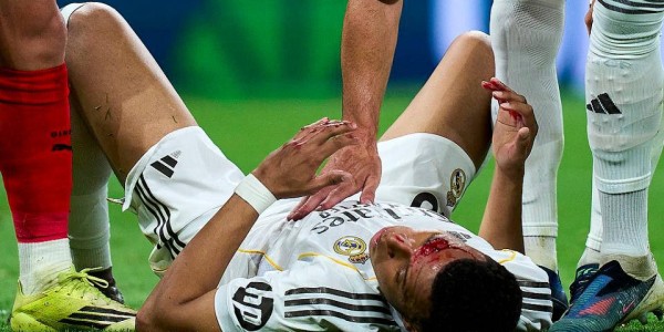 争议再起！姆巴佩受伤流血，主裁拒判点球，皇马官方强烈指责西甲暗箱操作